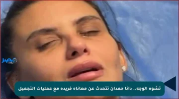 تشوه الوجه.. دانا حمدان تتحدث عن معاناة فريدة مع عمليات التجميل